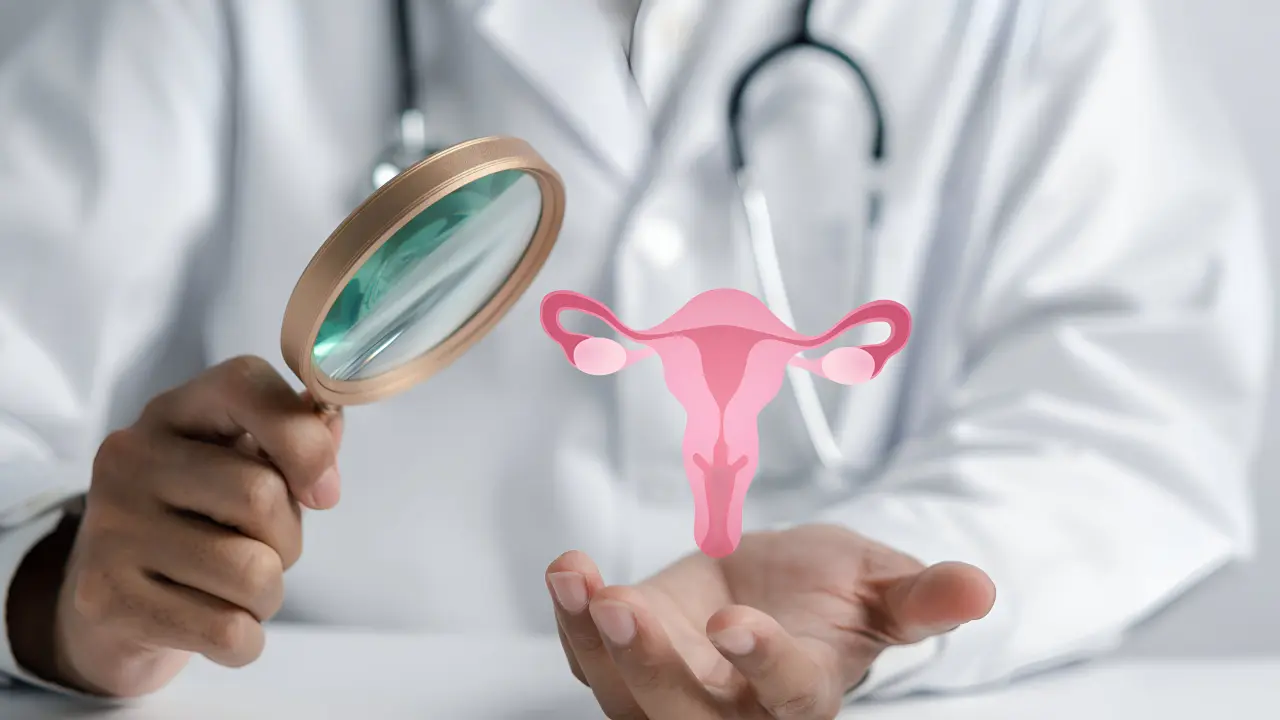 PCOS Treatment in Pakistan_ Natural Solutions for Polycystic Ovary Syndrome