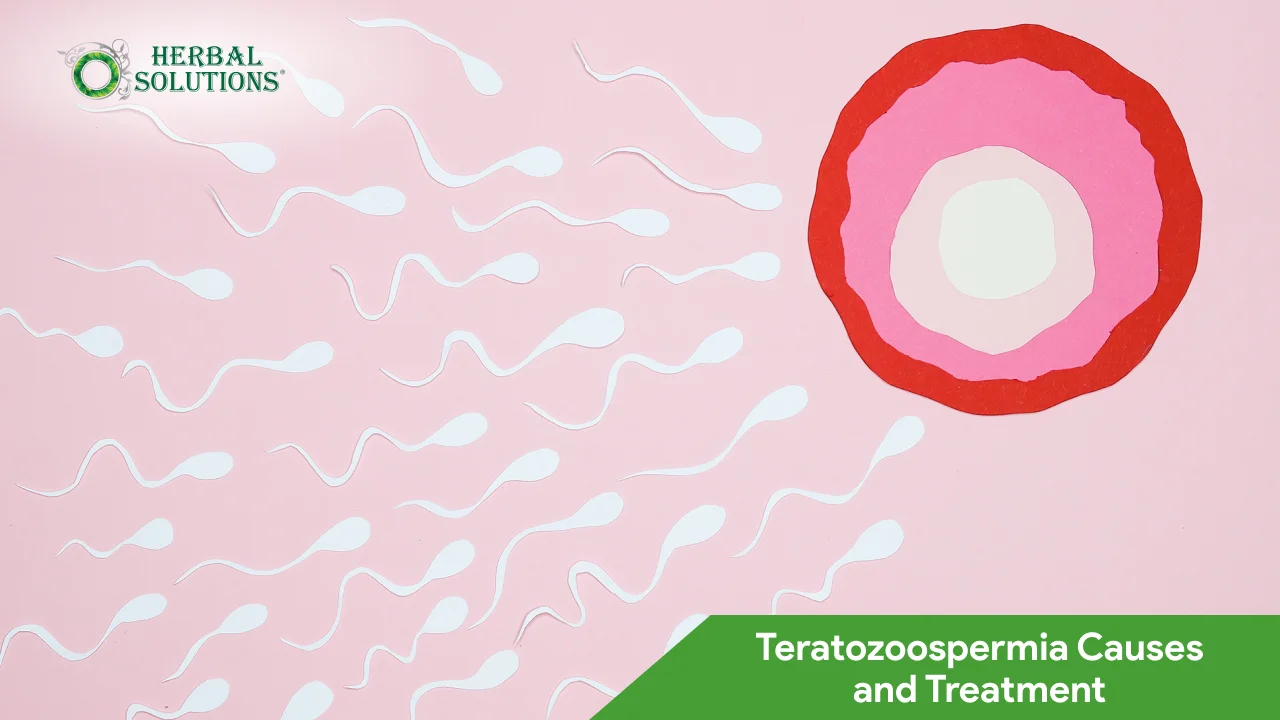 Teratozoospermia Causes and Treatment