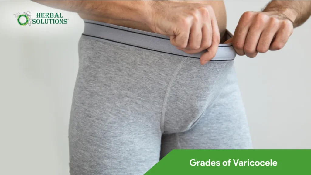 Grades of Varicocele